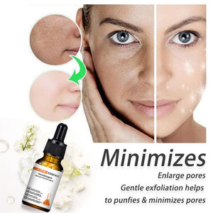 2022 New Instant Perfection Wrinkles Essence-BUY 2 FREE SHIPPING